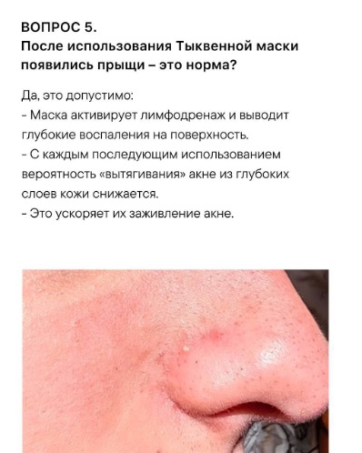 Изображение выглядит как текст, снимок экрана, кожа, крупный планКонтент, сгенерированный ИИ, может содержать ошибки.